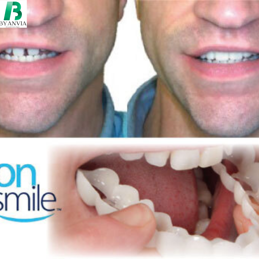 PerfectSmile™ Sonríe con seguridad cuando quieras